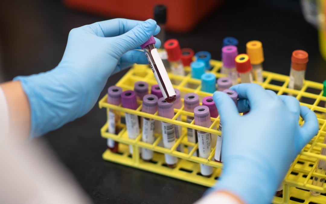 Liquid Biopsies for Cancer Detection