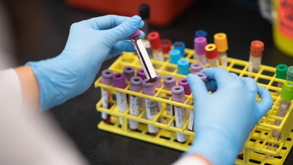 Cancer Diagnostic in a Drop
