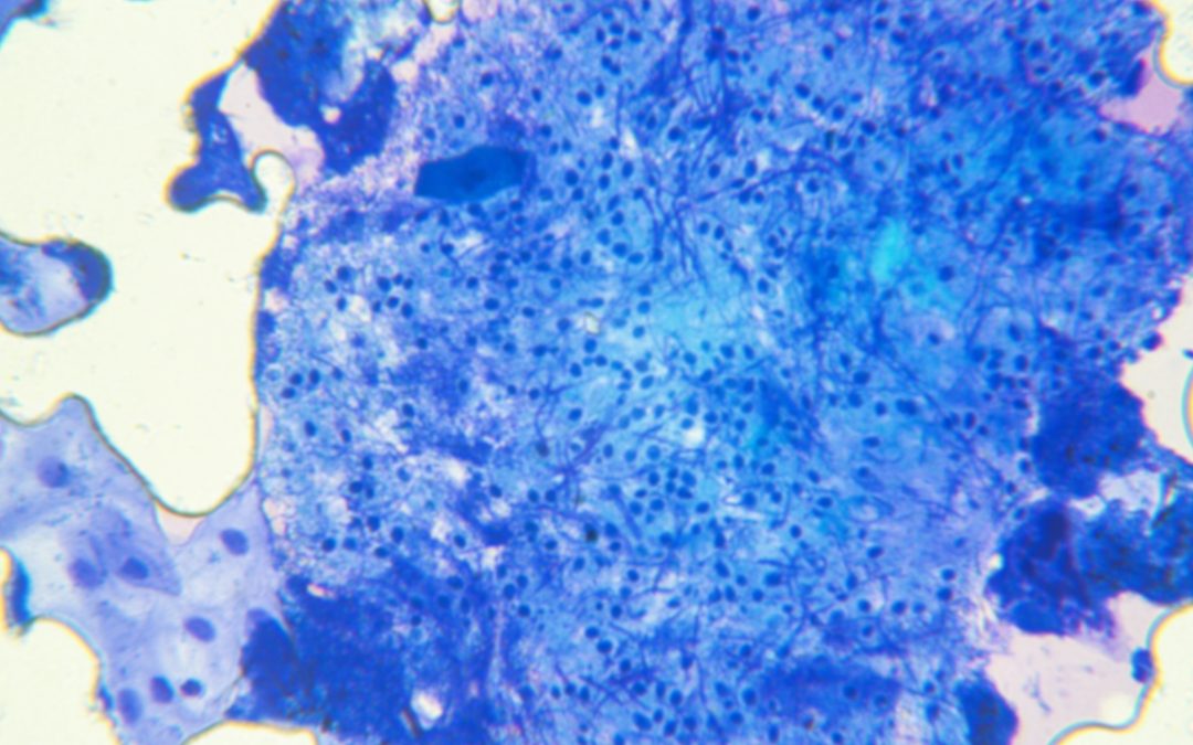 Cultured Cells: An Ex-Cell-ent Research Partner