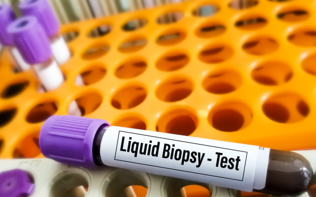 Liquid Biopsies Redefine Cancer Care