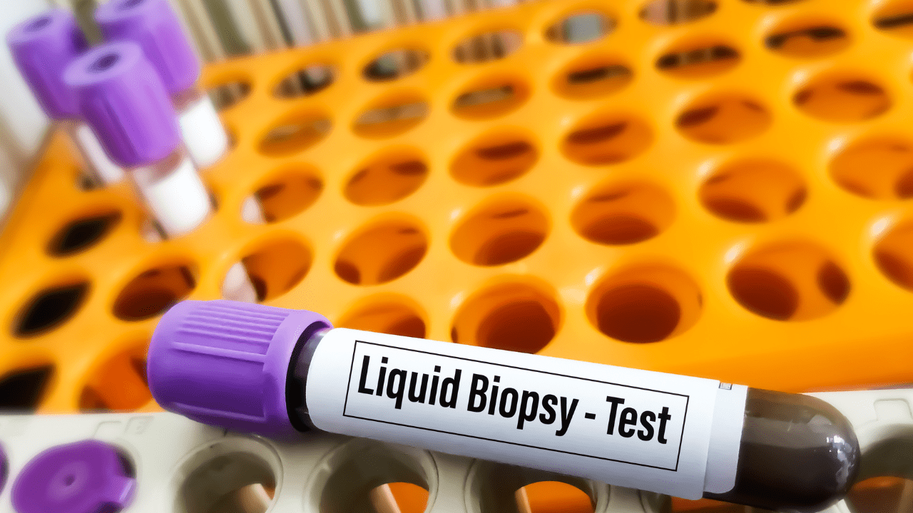 Liquid Biopsy liquid biopsy collection vial